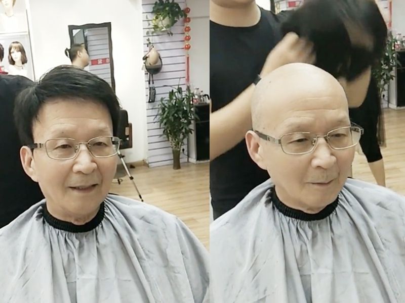 北京哪家补发假发好，什么是补发