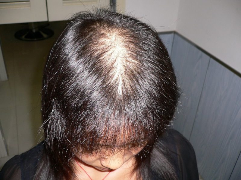 卡尔顿织发多少钱？织发是否靠谱呢？