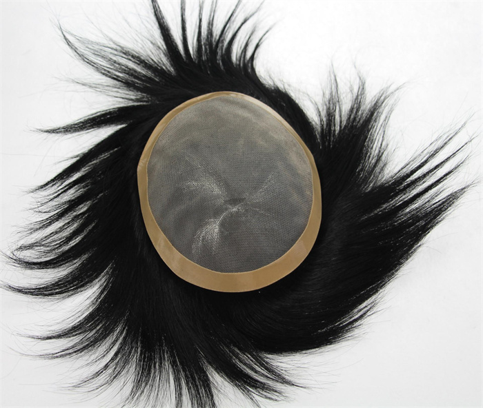 补发片一般多少钱？