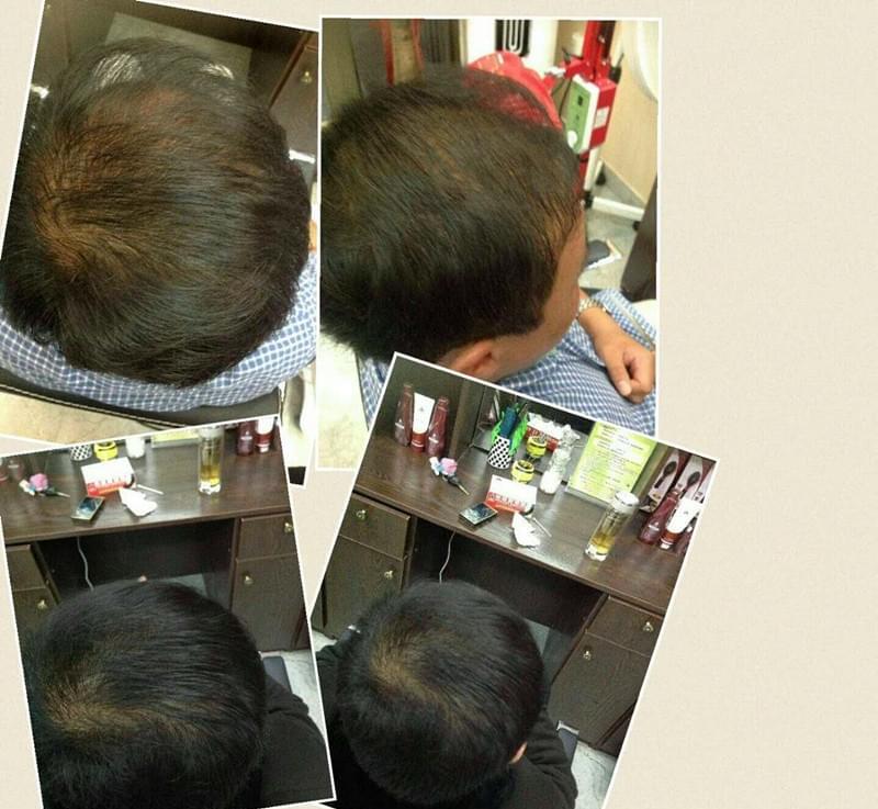 唐风采治白发怎么样？什么原因导致白头发？