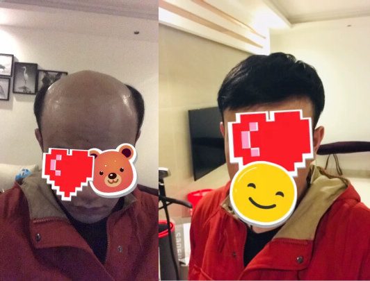 青岛极客侠假发店在哪里？（极客侠假发青岛店地址）