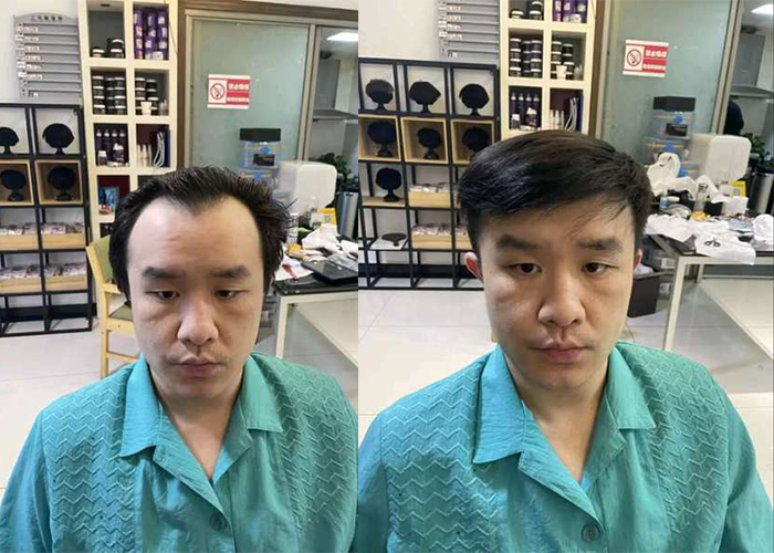太原男士假发定制哪家最好？（参考过来人评价）