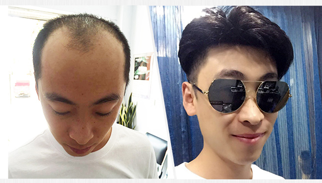 补发效果好吗？（补发效果怎么样）