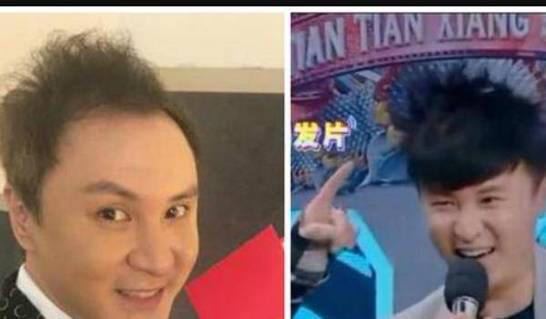 男明星有没有戴假发的？（已解答）