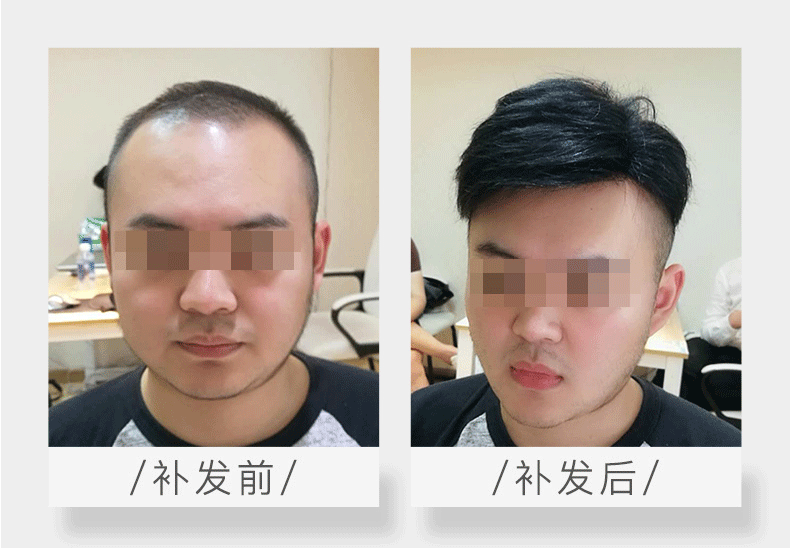 补发是什么意思？（补发全面诠释）