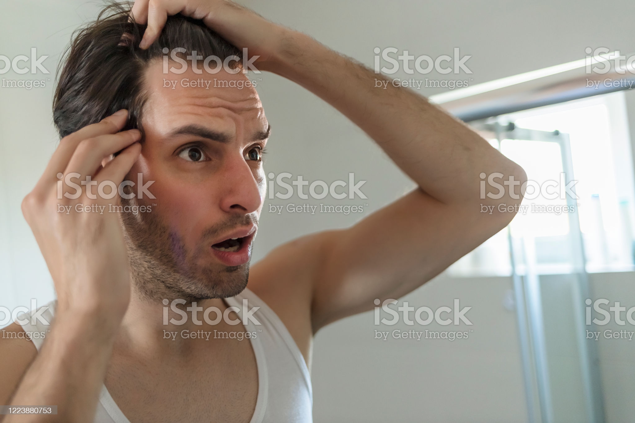 发际线过高戴假发好不好？（发际线过高戴假发效果）