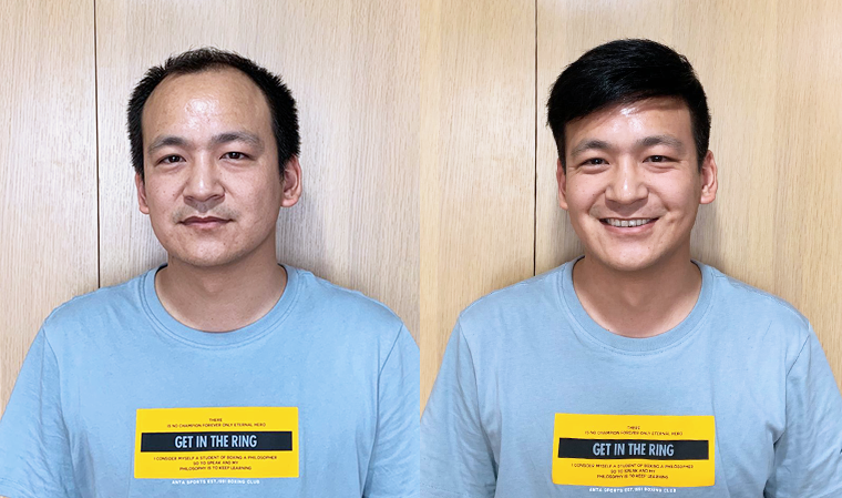 织发补发效果