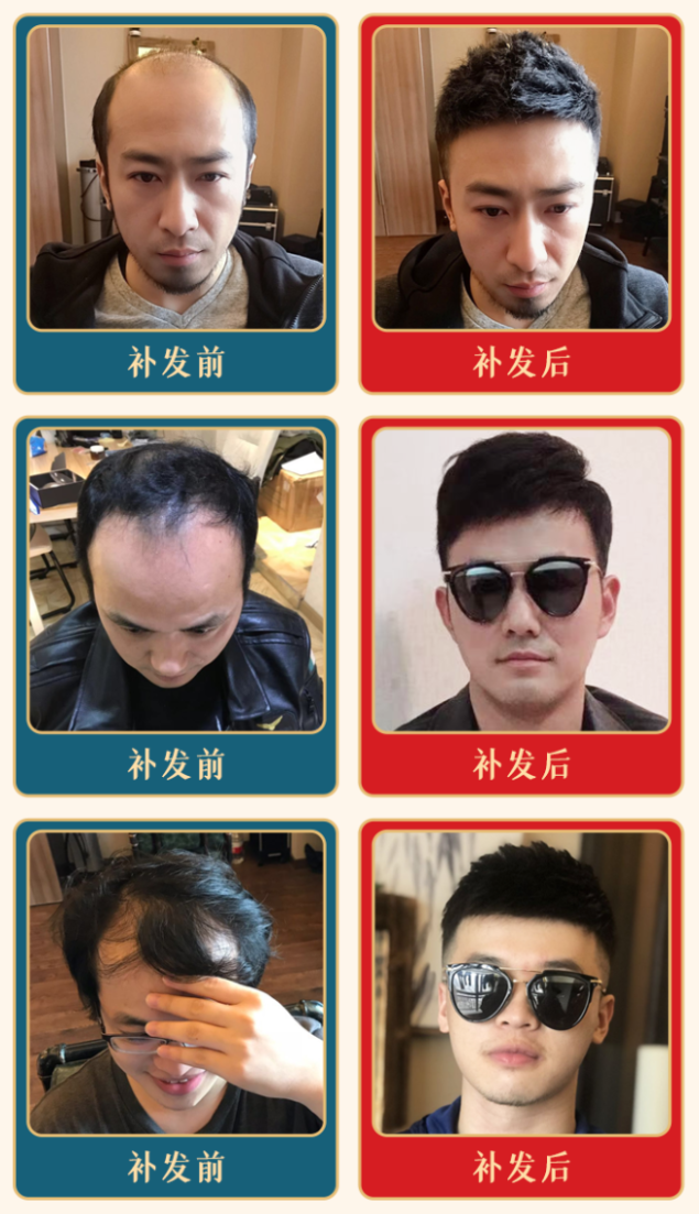 什么假发好