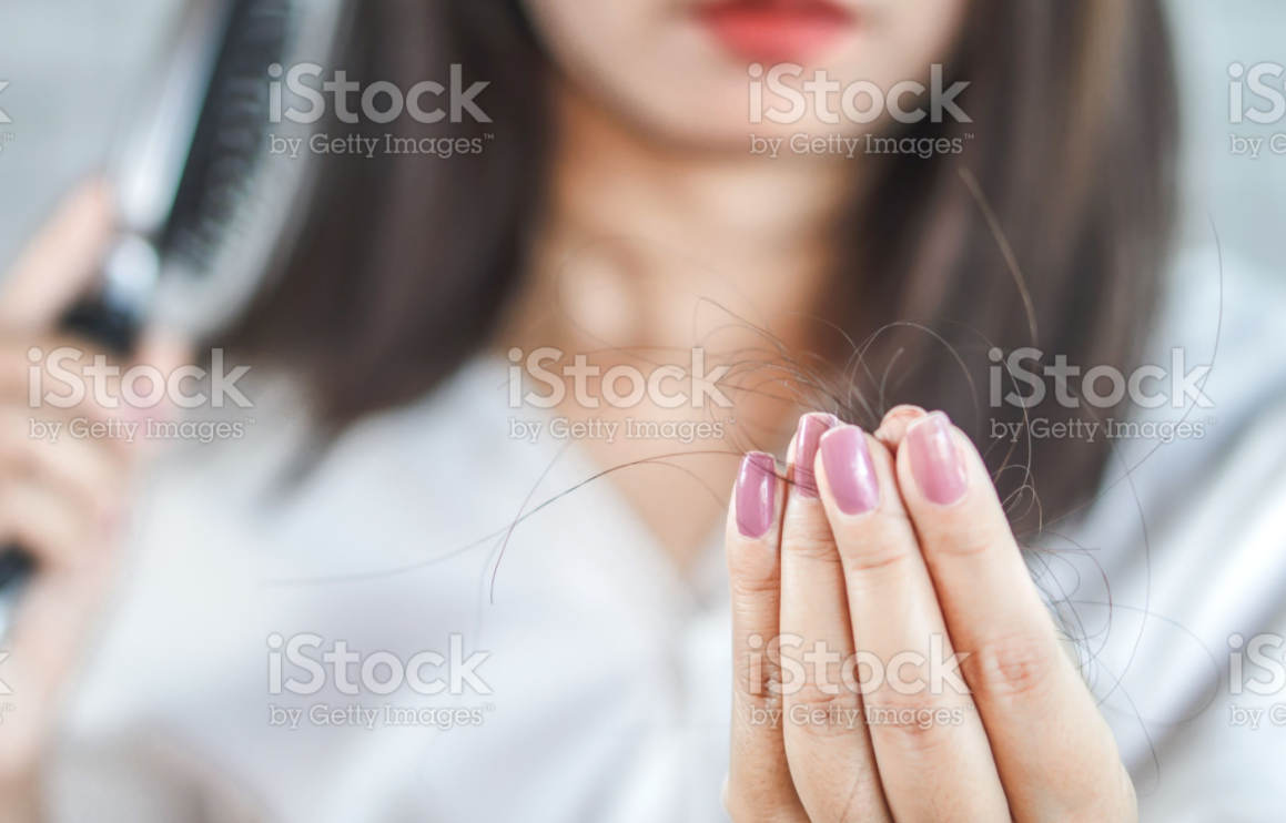 严重脱发是什么原因？（严重脱发的原因分析）