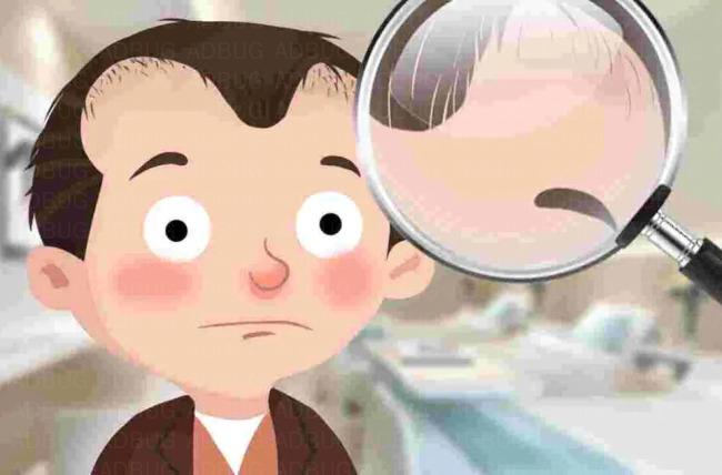 假发片是什么？（谢顶、白发可用）