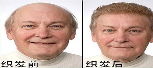 戴着假发片睡觉好吗？（过来人分享假发片）