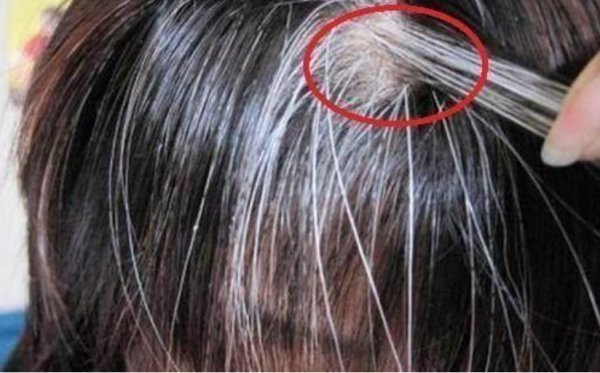 一个织发补发大概能用多久?（业内人士分享）