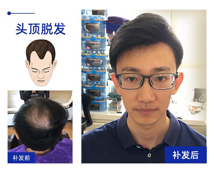 补发效果图3