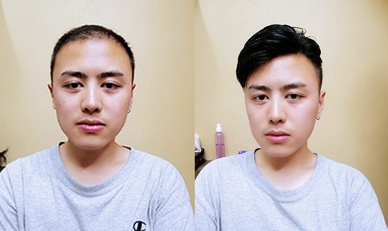 织发补发前后效果对比图