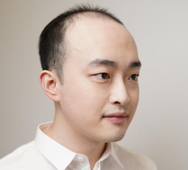 补发和植发有什么区别？价格都是多少？