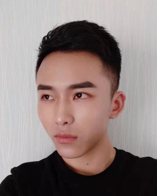 植发一年后又脱发到底是怎么回事？