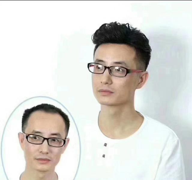补发织发多少钱大概，价格会很贵吗？