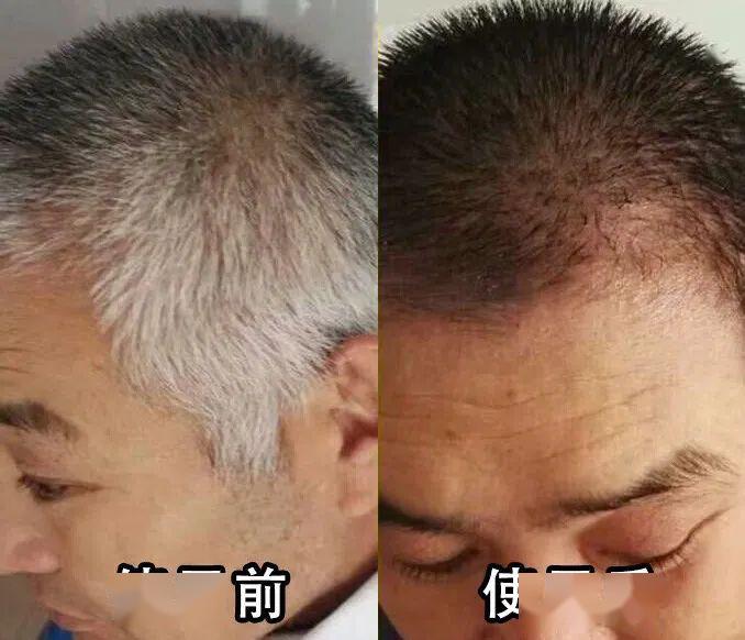 白发养发护发方法大全