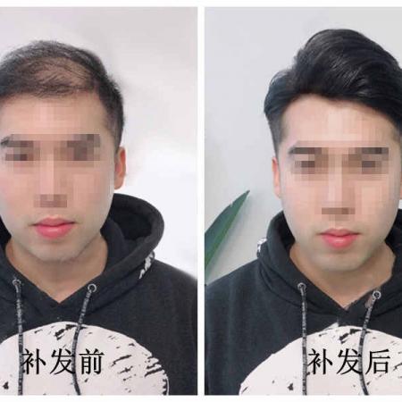 织发补发价格一般是多少，选择什么机构？