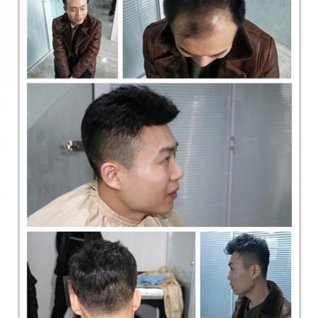 织发补发价格一般是多少,如何选择机构?