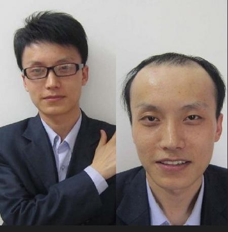 一般补发多少钱？补发需要多长时间？