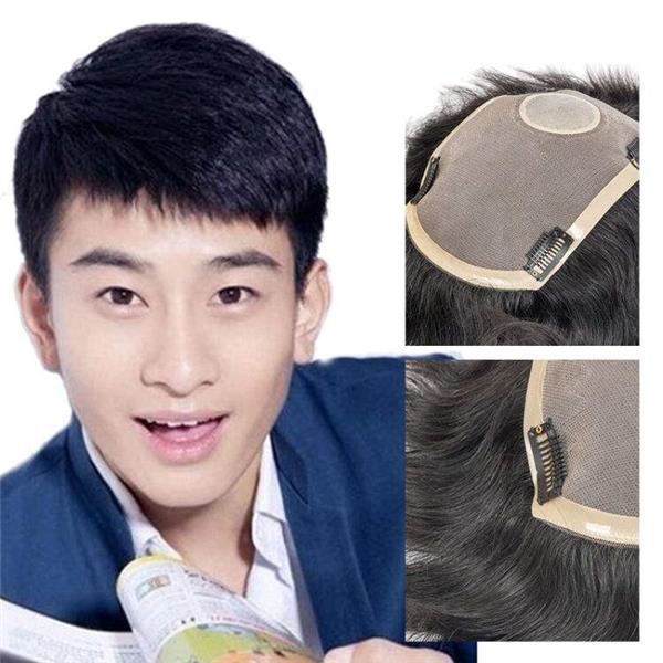 上海织发补发价格多少钱？织发补发有什么优势？