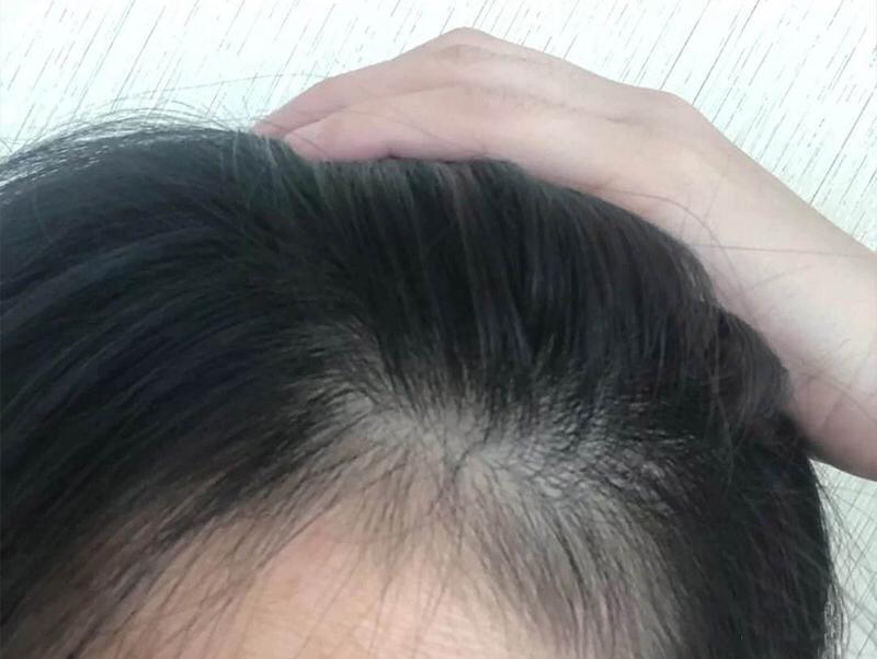 女生生发吃什么最好？吃什么可以改善发质？