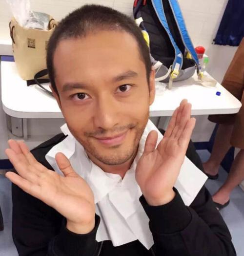 植发后还会脱发吗，脱发了该怎么办？