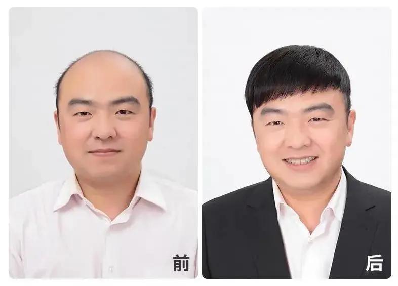 隐形织发是什么意思，隐形织发多少钱