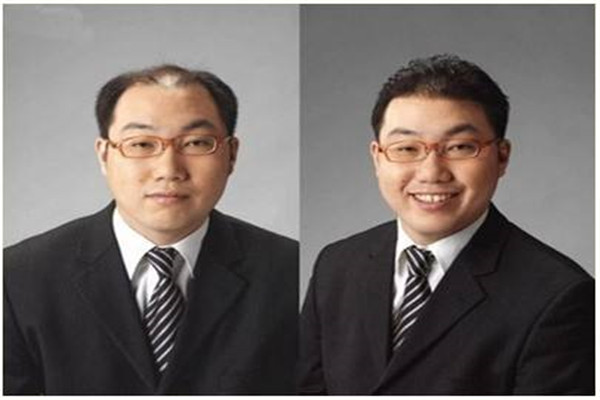补发织发费用是多少?哪些人适合补发织发