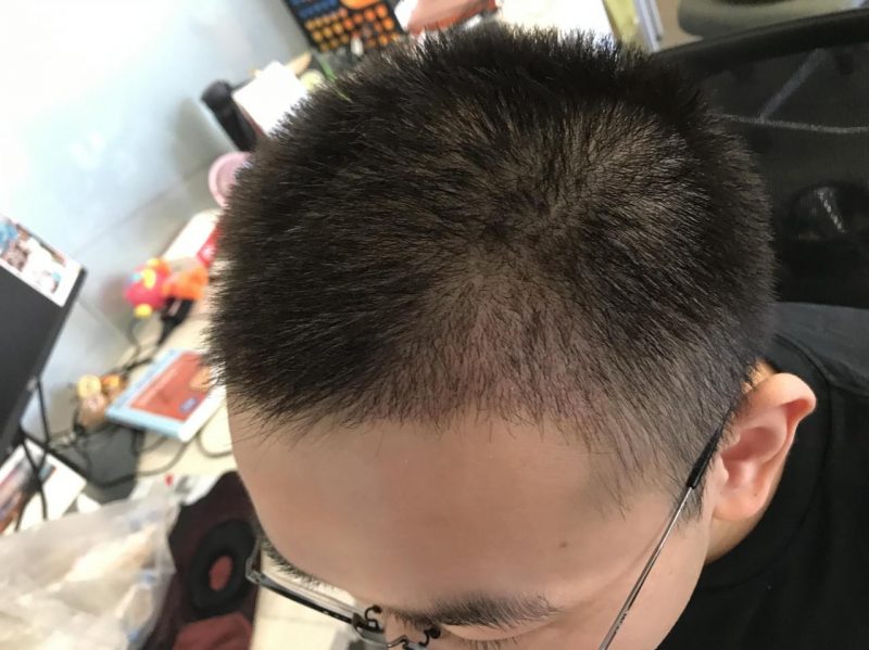 男生生发吃什么最好