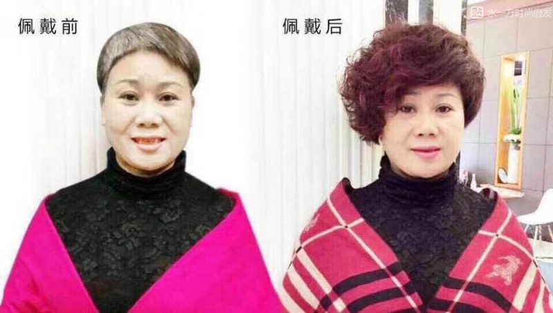 补发织发价格是多少