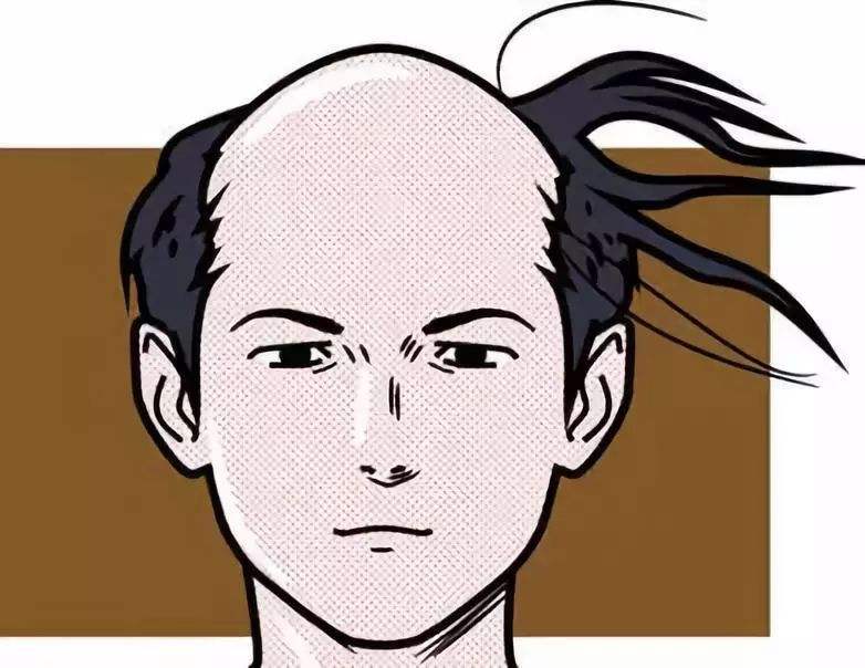 男性脱发是什么原因引起的
