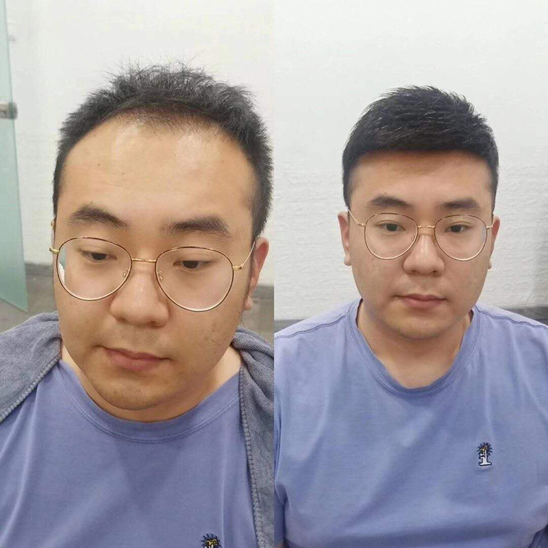 男士假发什么价位的比较真