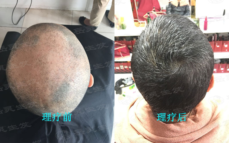 男人养发吃什么最好 90后也应该开始养发了