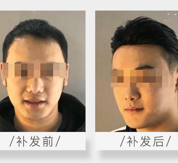 极客补发加盟