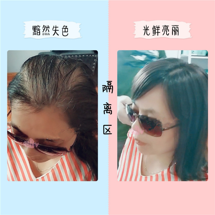 定制假发多少钱一套?定制假发什么机构好