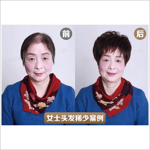 定制假发多少钱一套
