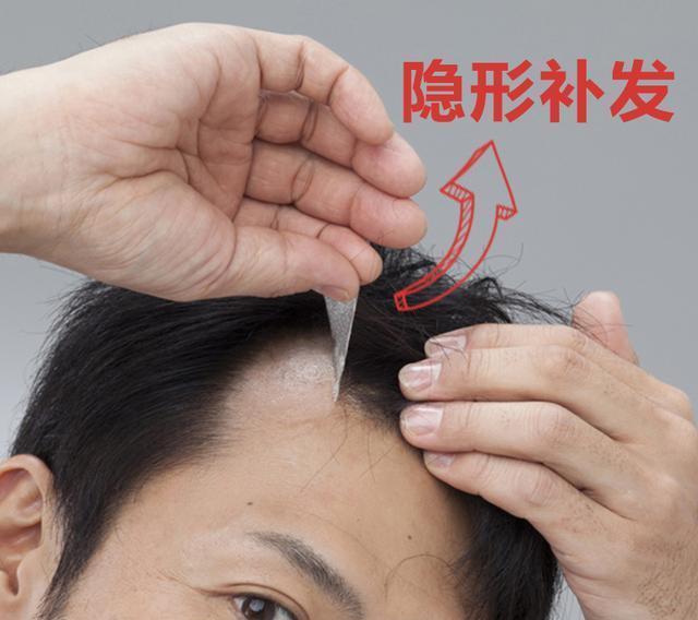 邵东唐风采怎么样？补发和植发哪个好