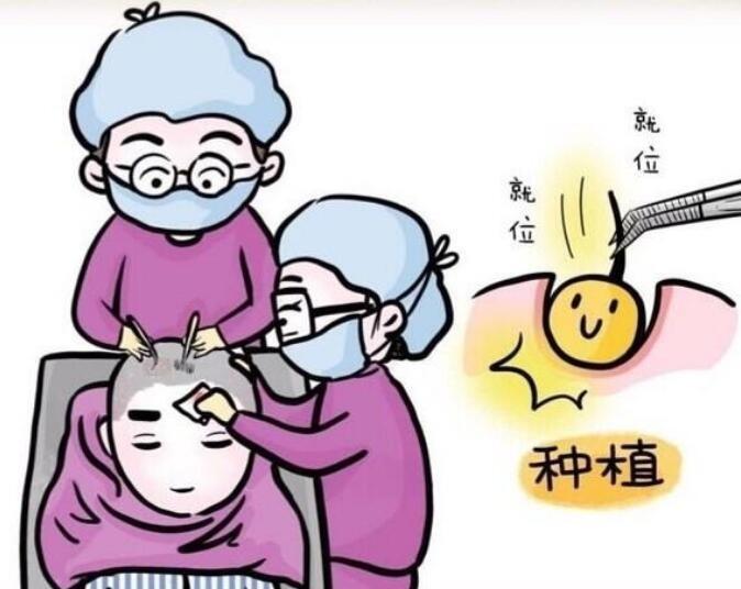 植发后多久长出新发?植发和补发哪个比较好?