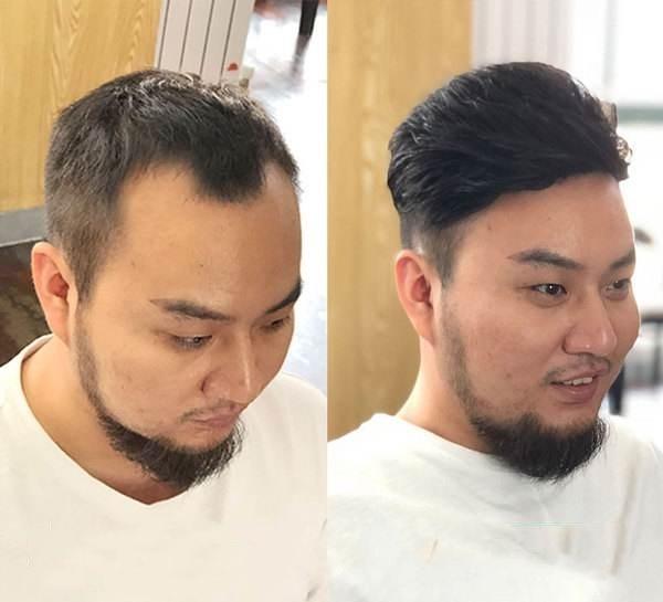 补发织发多少钱加盟