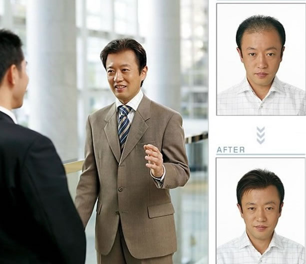 哈尔滨哪里有织发补发的地方