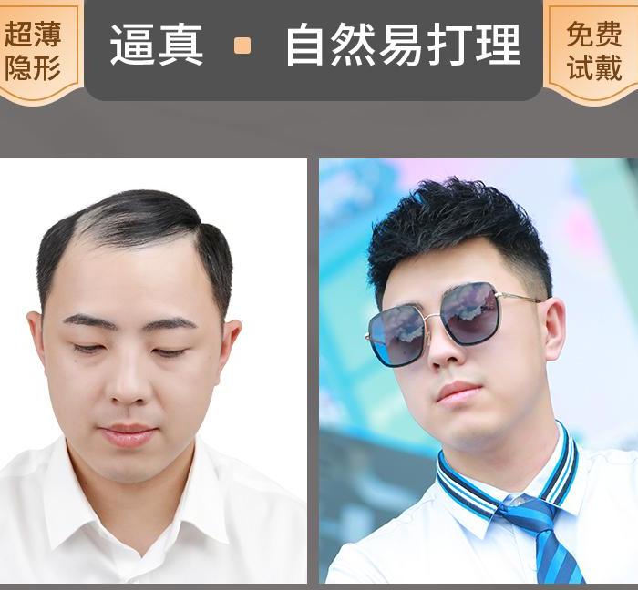 加盟唐风采增发要多少钱？唐风采增发加盟条件是什么？