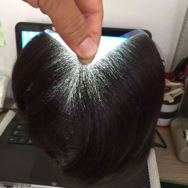 定制假发一般多少钱？定制假发有什么优点？