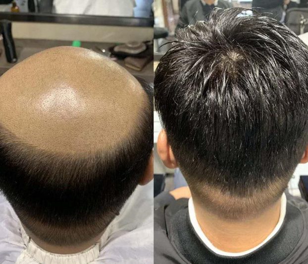 假发连锁店哪个品牌好？如何才能拥有发量浓密的头发？