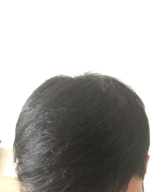 中国哪里生产补发织发的厂家？补发优势有哪些？