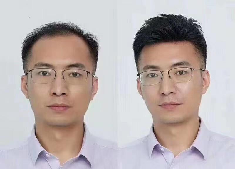 织发补发多久换一次 织发和补发有什么区别