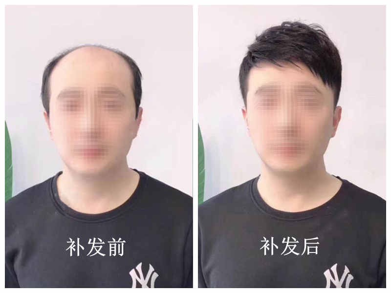 真发织发补发订制