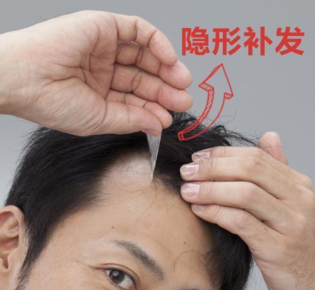 无锡唐风采织发补发怎么样？补发需要多少时间