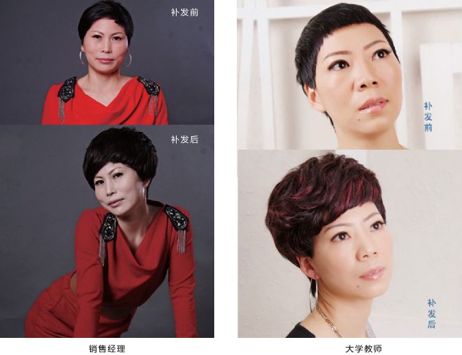 唐风采假发店口碑怎么样？补发的优势